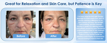 Electric Face Massager